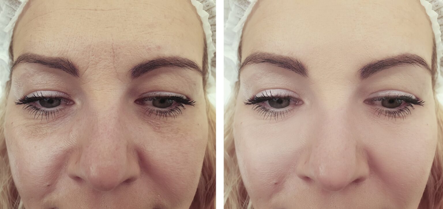 dr-krushel-botox-255823656_L-85p-2000px